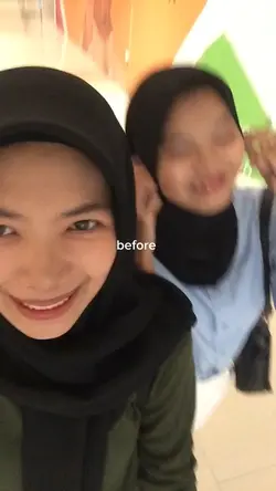 before after