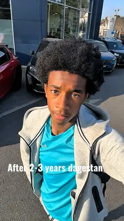 2-3 years dagestan