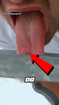 Tongue