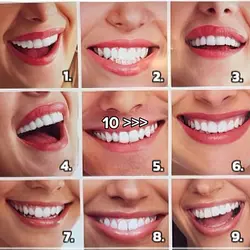 who has cutest smile