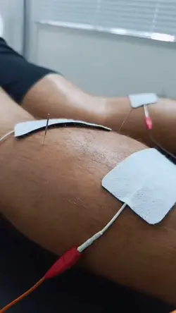 Fisioterapia 