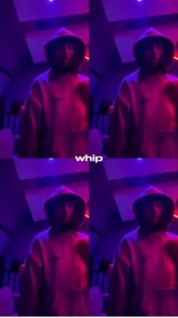 STM x WHIP