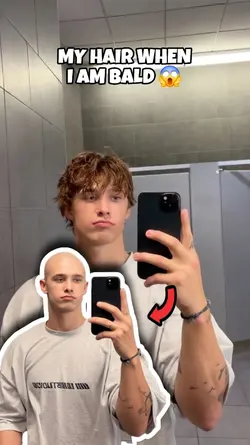 bald hair 