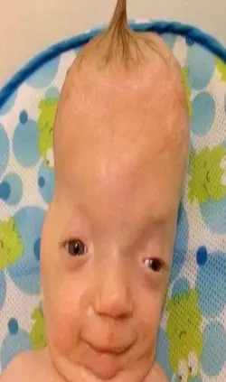 :)