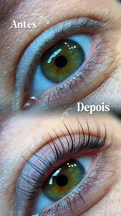Antes e depois 