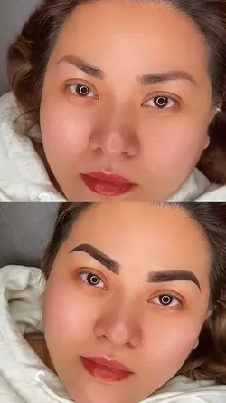 Antes e depois 