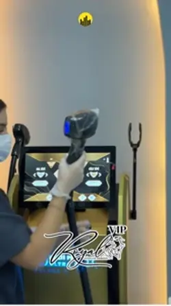 Lazer epilasyon