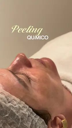 Estética facial
