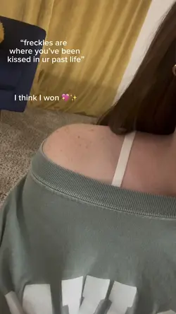 Freckles 