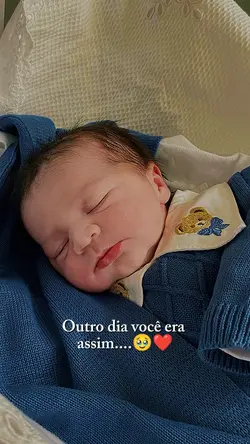 Antes e depois 