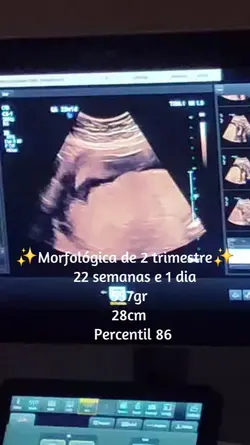 E por aí meninas ?