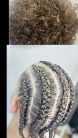 Braids
