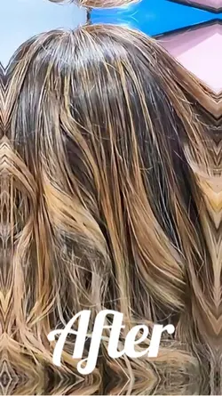 Estética