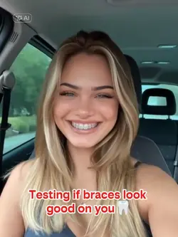 Braces Filter 