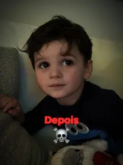 antes x depois 