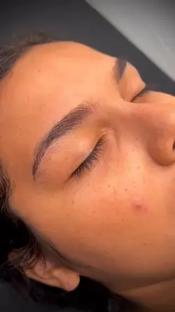 brow transformation