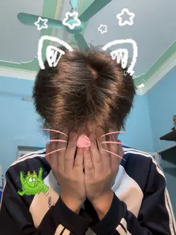 Trend tai mèo đây