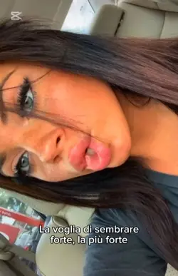 …