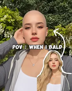 POV bald hair