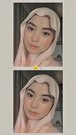 Filter estetik