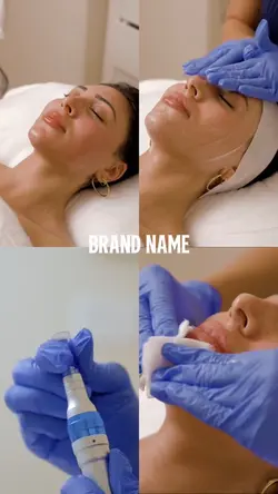 Microneedling