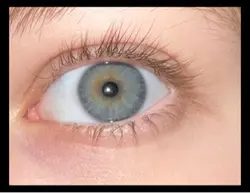 eye filter 