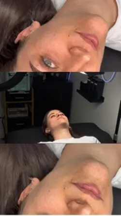 Change in Eyebrows
