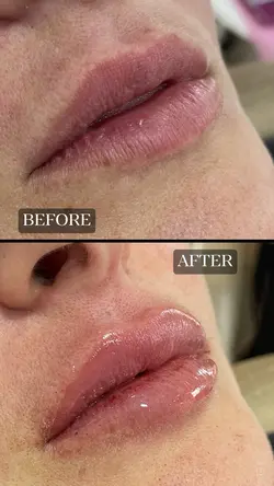 BEFORE X AFTER