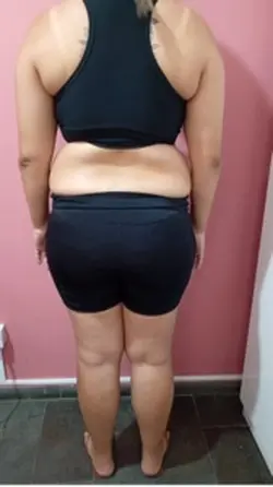 Antes e depois 