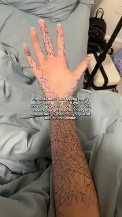 Um