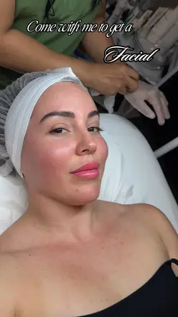 CWM for a facial