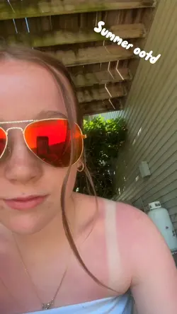 Summer Ootd