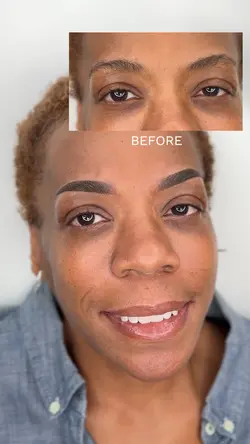 Before After Brows