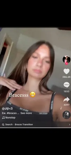 braces