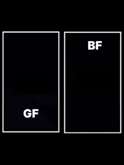 GF vs BF TREND