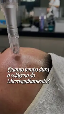 Microagulhamento
