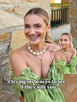 Braces Filter Ai 