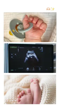 Ultrasound pregnant