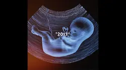 2017 