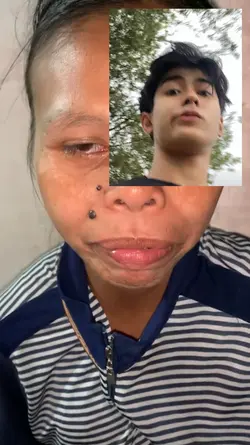 Mark miss na kita