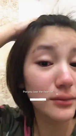 You lose the facefat