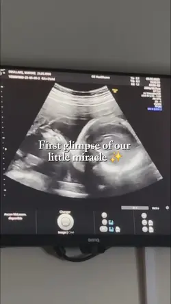 our little miracle