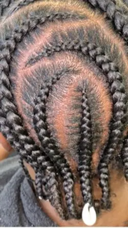 Stitch braids 