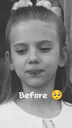 Before and After 