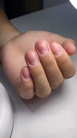 nails viral