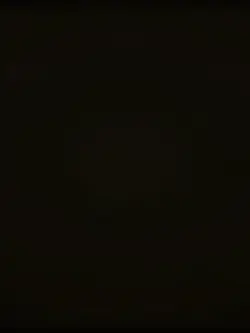 My eyes 