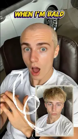 Bald