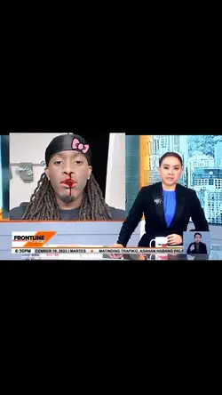 nabasag ang mukha? 