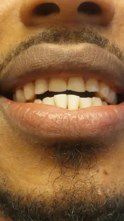 Sorriso novo