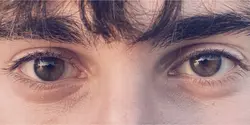 Eye Trend